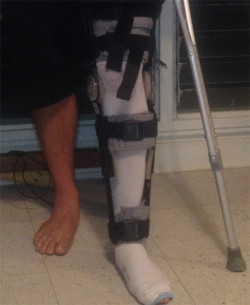 Travis Grant's knee injury